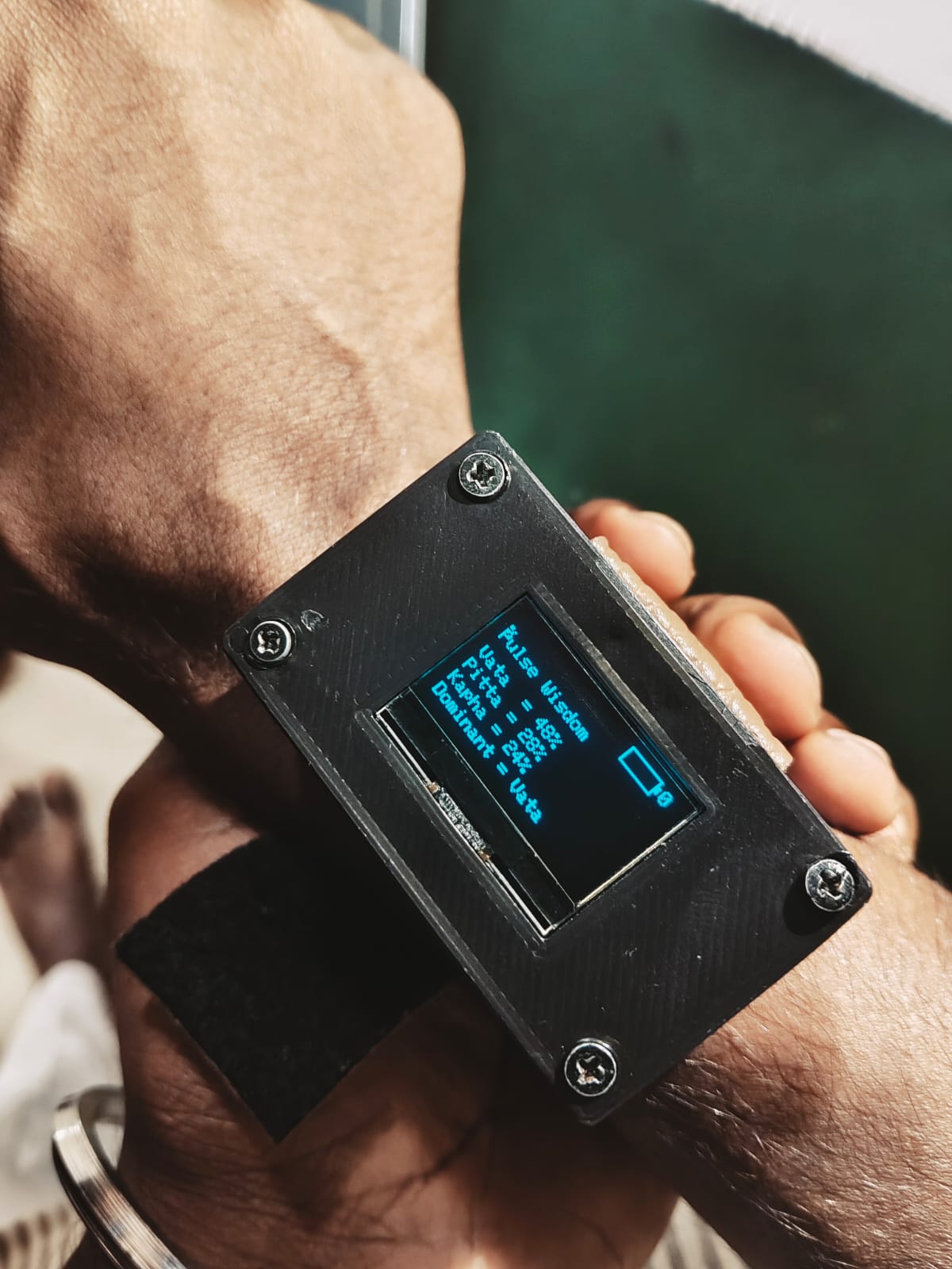Nadi Bio Band wearable device prototype showing ESP32 integration and OLED display
